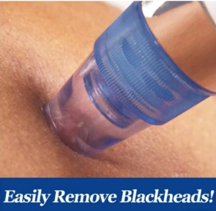 Pore Cleaning Device